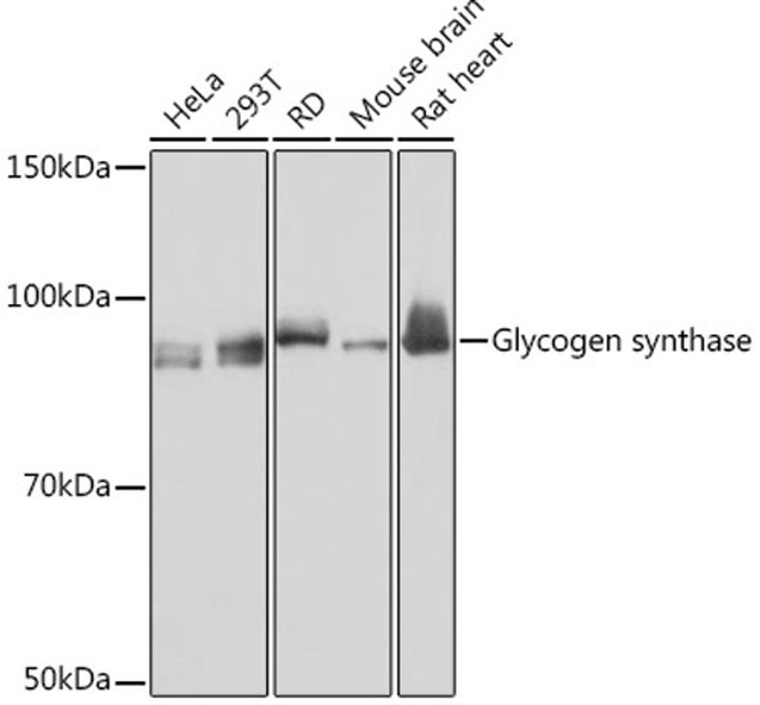 Western blot - Glycogen synthase Rabbit mAb (A8912)