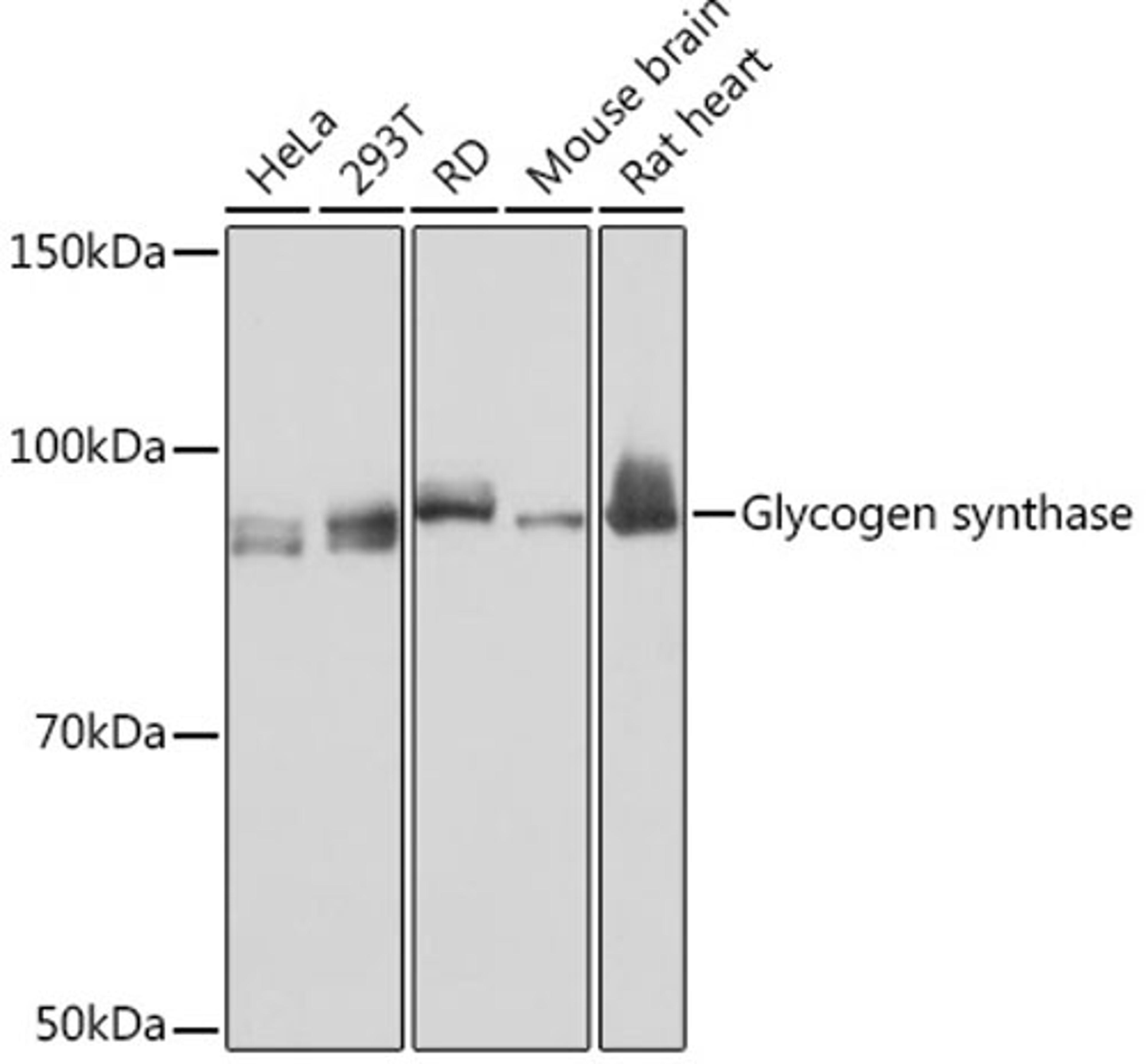 Western blot - Glycogen synthase Rabbit mAb (A8912)