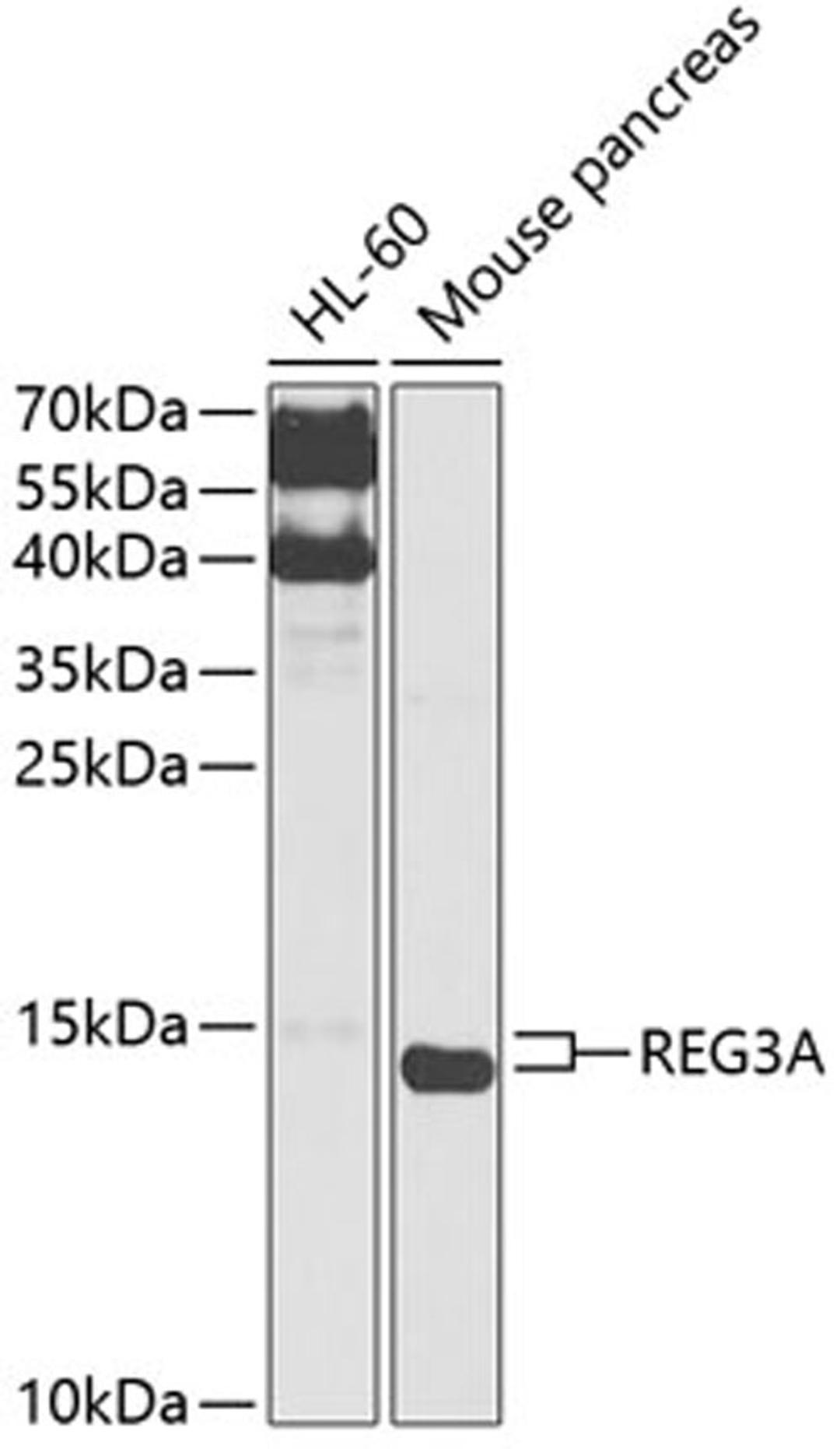 Western blot - REG3A antibody (A12479)