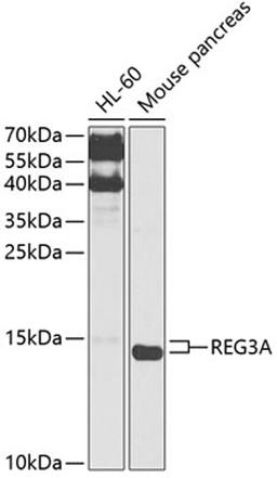 Western blot - REG3A antibody (A12479)