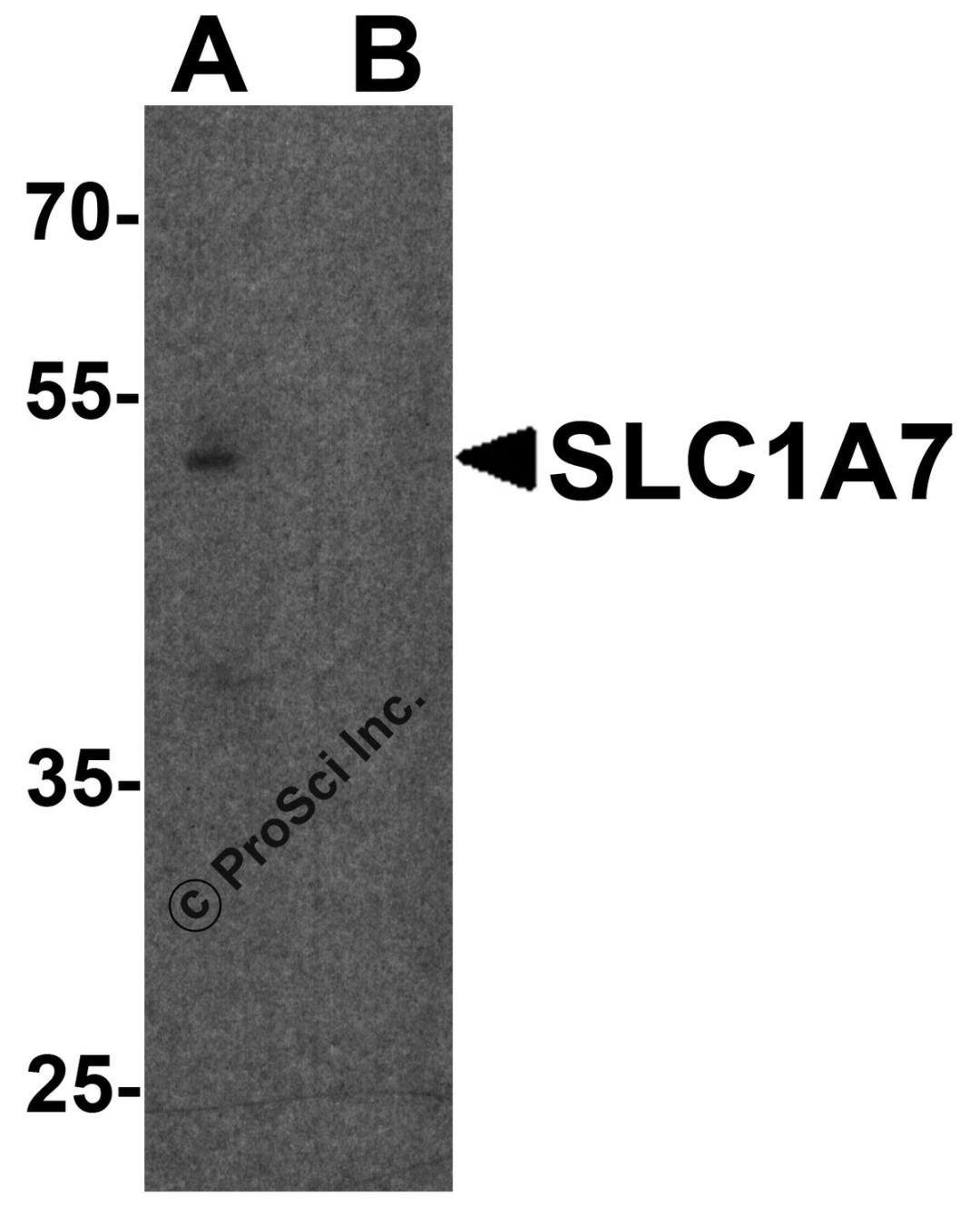 Western blot analysis of SLC1A7 in C2C12 cell lysate with SLC1A7 antibody at 1 μg/ml in (A) the absence and (B) the presence of blocking peptide.