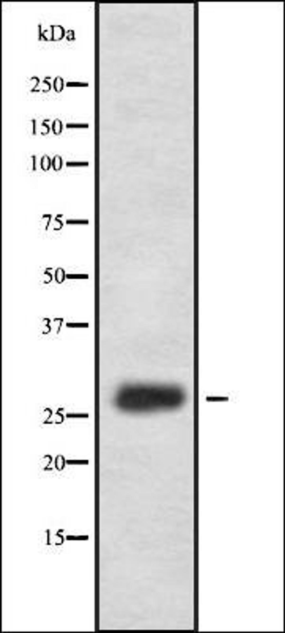 Western blot analysis of HEK293 cells using FA58A antibody