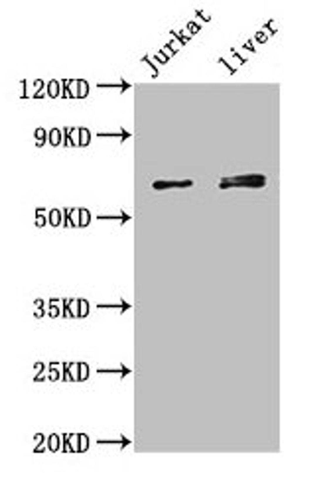 Western Blot. Positive WB detected in: Jurkat whole cell lysate, Mouse liver tissue. All lanes: KLHL2 antibody at 3µg/ml. Secondary. Goat polyclonal to rabbit IgG at 1/50000 dilution. Predicted band size: 66, 67, 57 kDa. Observed band size: 66, 67 kDa