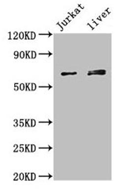 Western Blot. Positive WB detected in: Jurkat whole cell lysate, Mouse liver tissue. All lanes: KLHL2 antibody at 3µg/ml. Secondary. Goat polyclonal to rabbit IgG at 1/50000 dilution. Predicted band size: 66, 67, 57 kDa. Observed band size: 66, 67 kDa