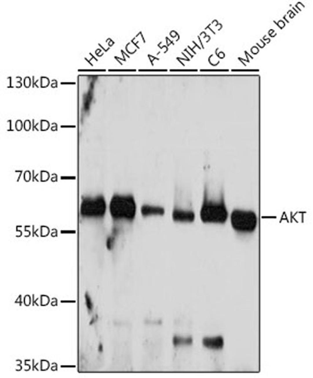 Western blot - AKT antibody (A18120)