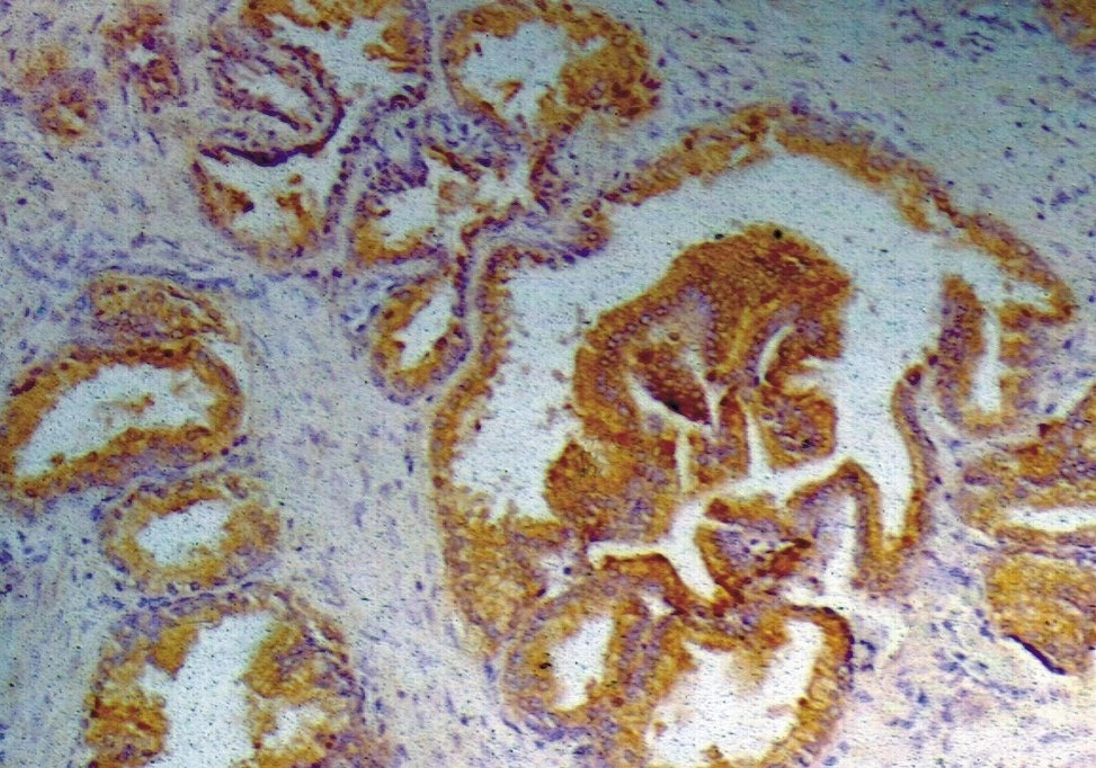 Immunohistochemistry staining of human Prostate using Prostate-specific antigen (PSA) antibody (Biotin).