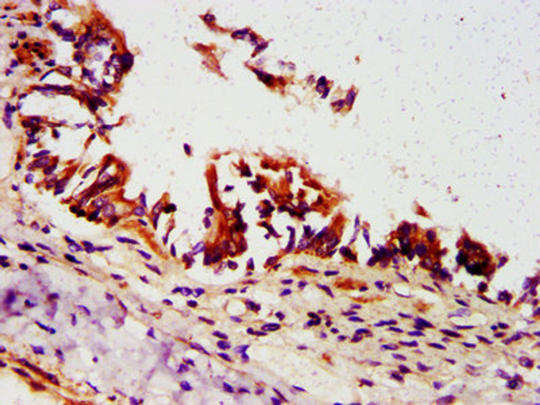IHC image of CSB-PA854016LA01HU diluted at 1:500 and staining in paraffin-embedded human lung tissue performed on a Leica BondTM system. After dewaxing and hydration, antigen retrieval was mediated by high pressure in a citrate buffer (pH 6.0). Section was blocked with 10% normal goat serum 30min at RT. Then primary antibody (1% BSA) was incubated at 4&deg;C overnight. The primary is detected by a biotinylated secondary antibody and visualized using an HRP conjugated SP system.