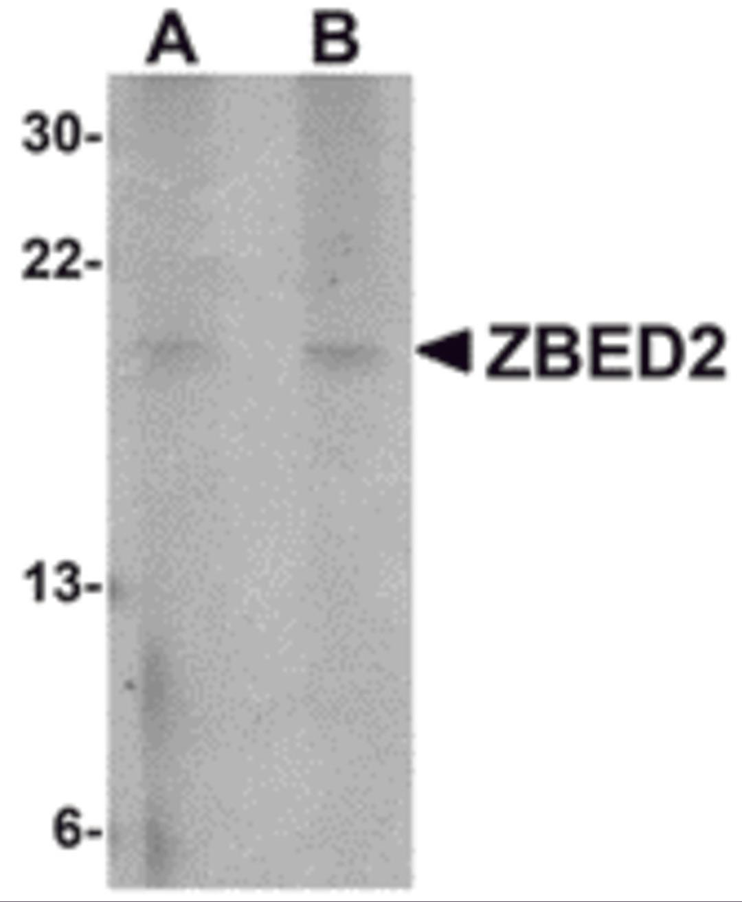 Western blot analysis of ZBED2 in A549 cell lysate with ZBED2 antibody at (A) 1 and (B) 2 &#956;g/mL.