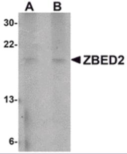 Western blot analysis of ZBED2 in A549 cell lysate with ZBED2 antibody at (A) 1 and (B) 2 &#956;g/mL.