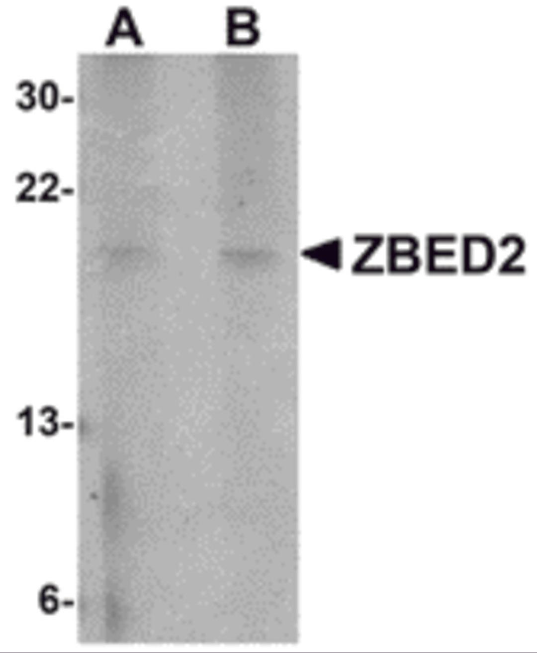 Western blot analysis of ZBED2 in A549 cell lysate with ZBED2 antibody at (A) 1 and (B) 2 μg/mL.