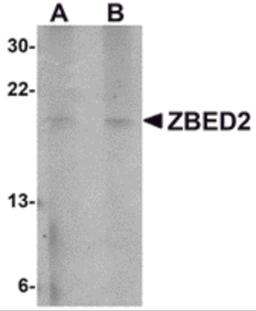 Western blot analysis of ZBED2 in A549 cell lysate with ZBED2 antibody at (A) 1 and (B) 2 μg/mL.