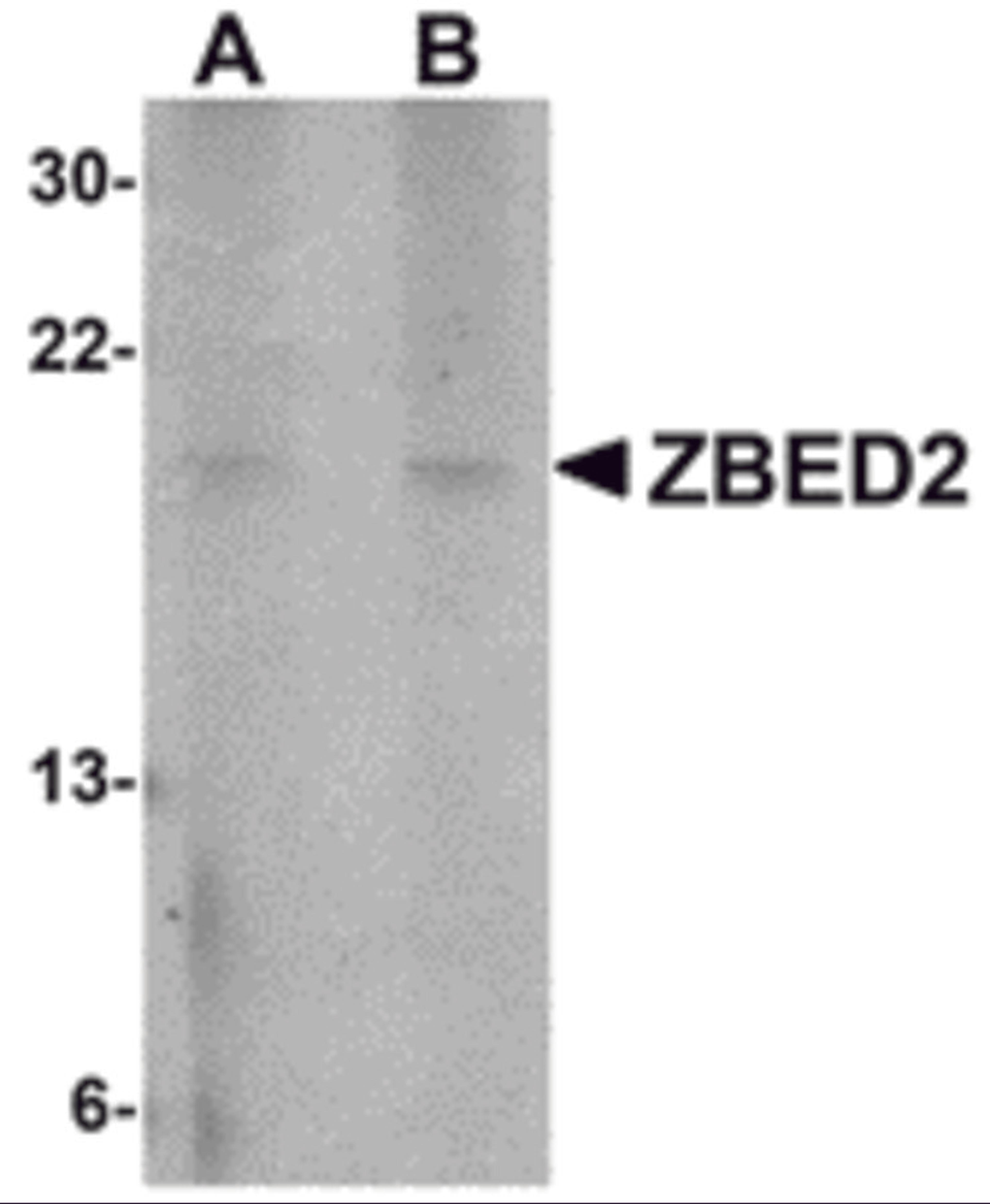 Western blot analysis of ZBED2 in A549 cell lysate with ZBED2 antibody at (A) 1 and (B) 2 μg/mL.