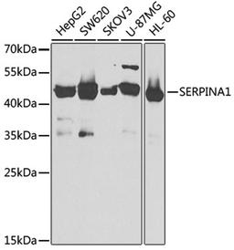 Western blot - SERPINA1 antibody (A1015)