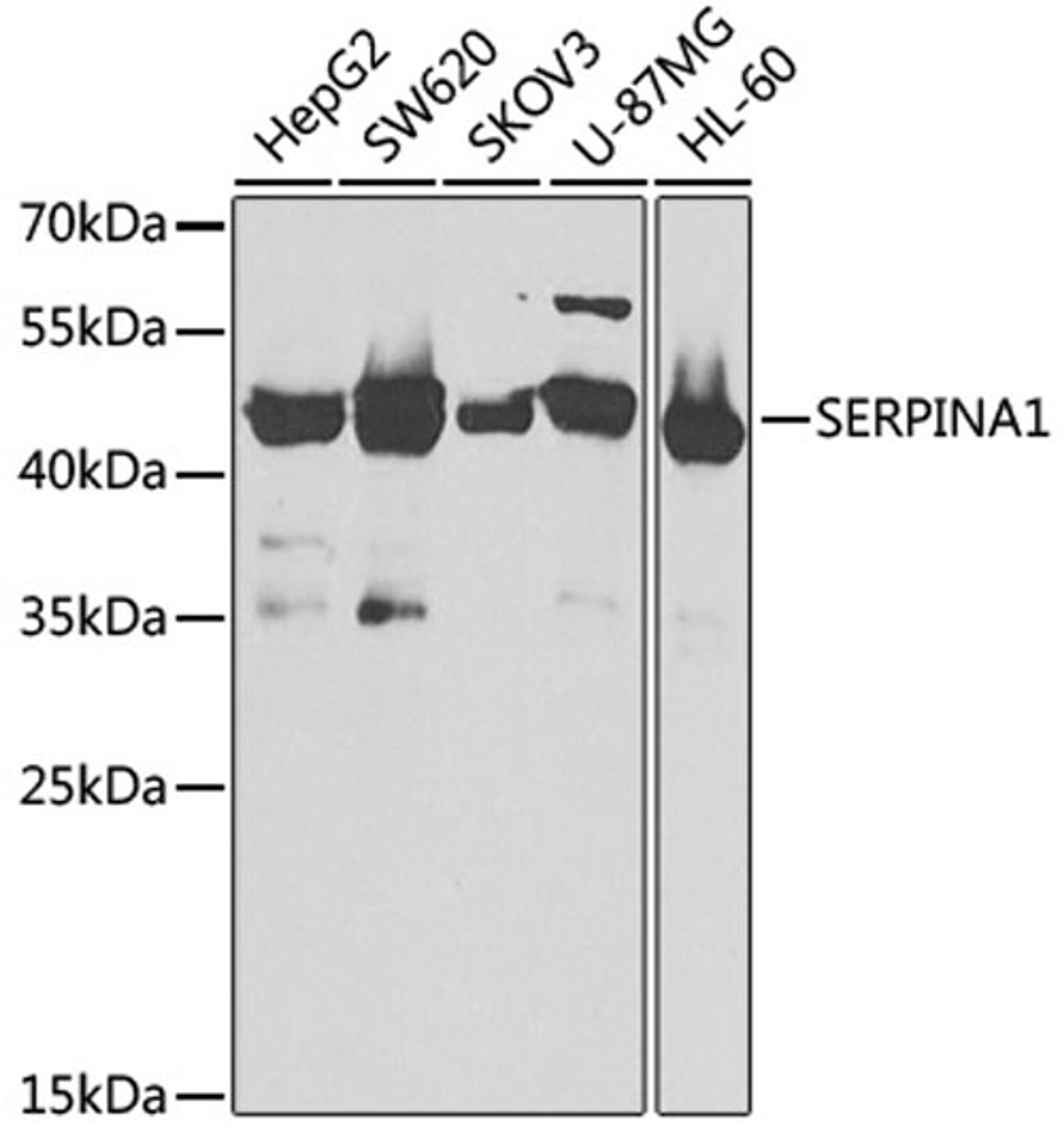 Western blot - SERPINA1 antibody (A1015)