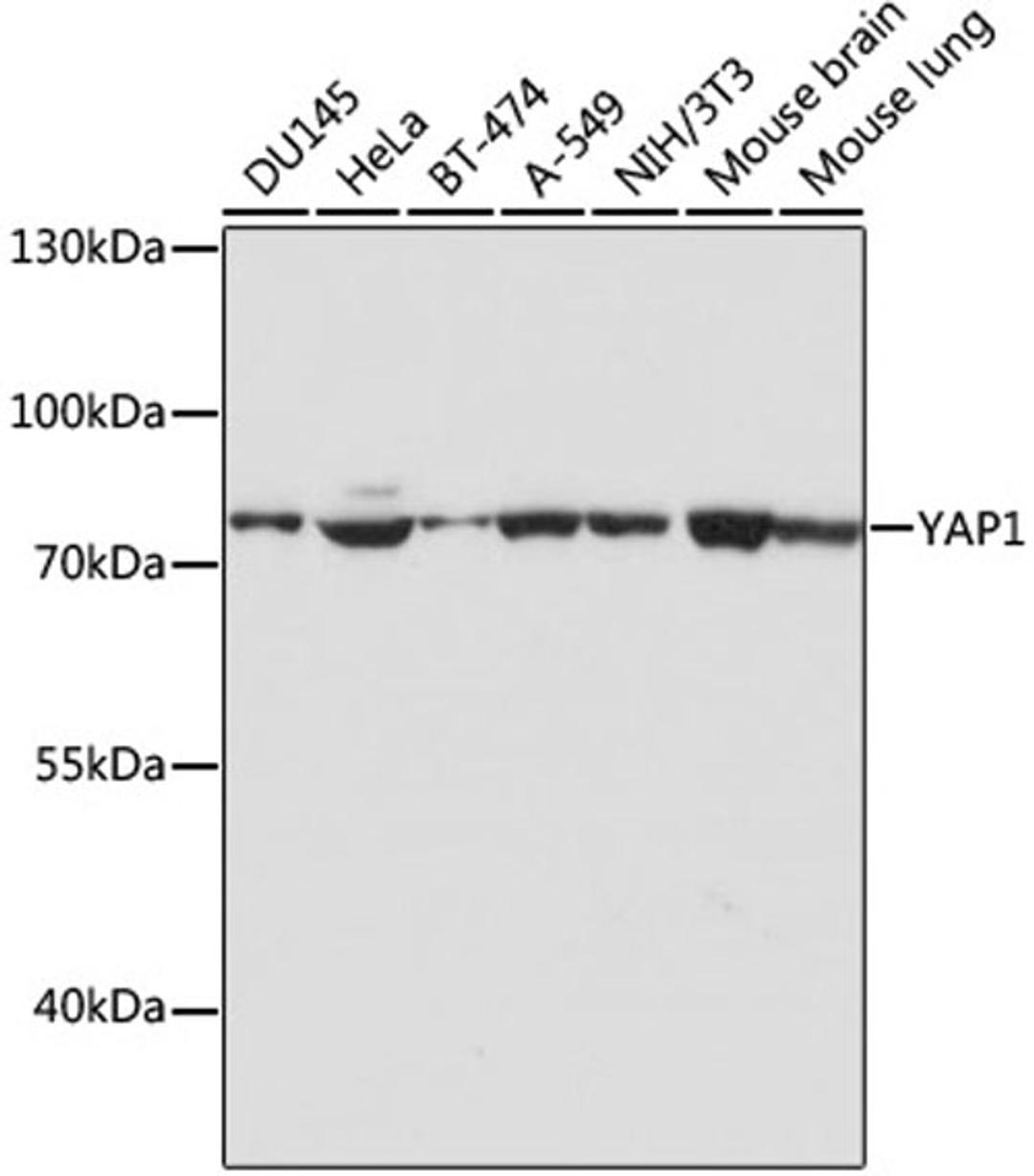 Western blot - YAP1 antibody (A17075)