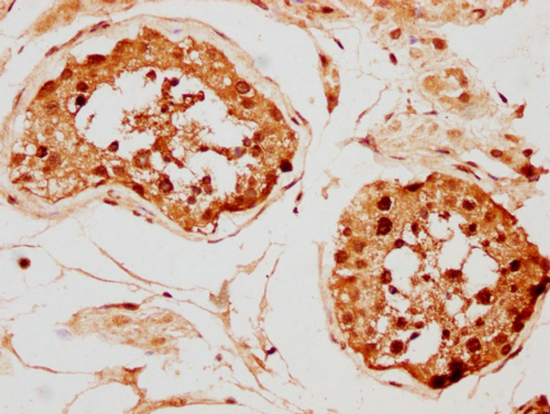 IHC image of CSB-PA010097PA142nphHU diluted at 1:20 and staining in paraffin-embedded human testis tissue performed on a Leica BondTM system. After dewaxing and hydration, antigen retrieval was mediated by high pressure in a citrate buffer (pH 6.0). Section was blocked with 10% normal goat serum 30min at RT. Then primary antibody (1% BSA) was incubated at 4°C overnight. The primary is detected by a biotinylated secondary antibody and visualized using an HRP conjugated SP system.