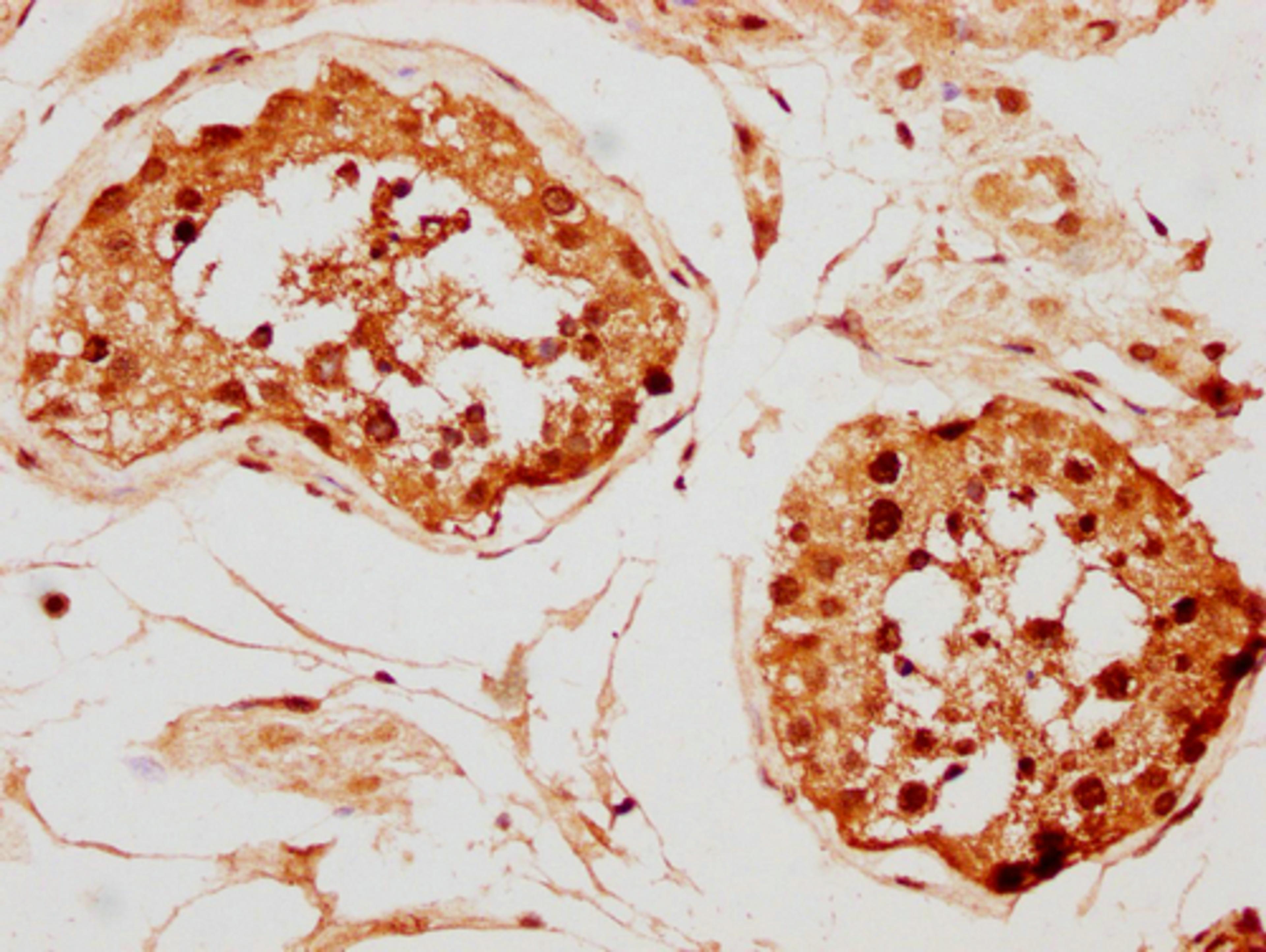 IHC image of CSB-PA010097PA142nphHU diluted at 1:20 and staining in paraffin-embedded human testis tissue performed on a Leica BondTM system. After dewaxing and hydration, antigen retrieval was mediated by high pressure in a citrate buffer (pH 6.0). Section was blocked with 10% normal goat serum 30min at RT. Then primary antibody (1% BSA) was incubated at 4°C overnight. The primary is detected by a biotinylated secondary antibody and visualized using an HRP conjugated SP system.