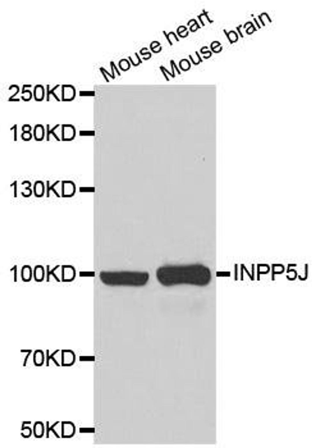 Western blot analysis of extracts of various cell lines using INPP5J antibody