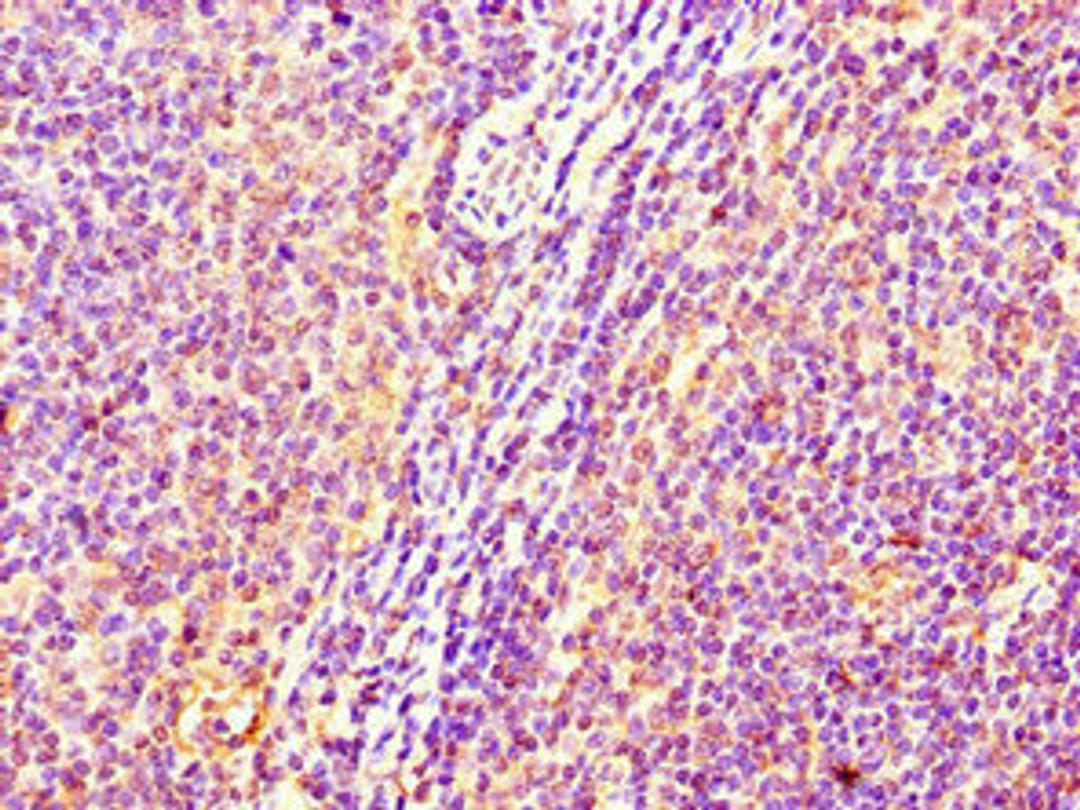 Immunohistochemistry of paraffin-embedded human lymph node tissue using CSB-PA643573LA01HU at dilution of 1:100