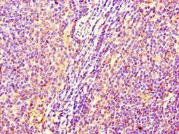 Immunohistochemistry of paraffin-embedded human lymph node tissue using CSB-PA643573LA01HU at dilution of 1:100
