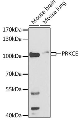 Western blot - PRKCE antibody (A2110)