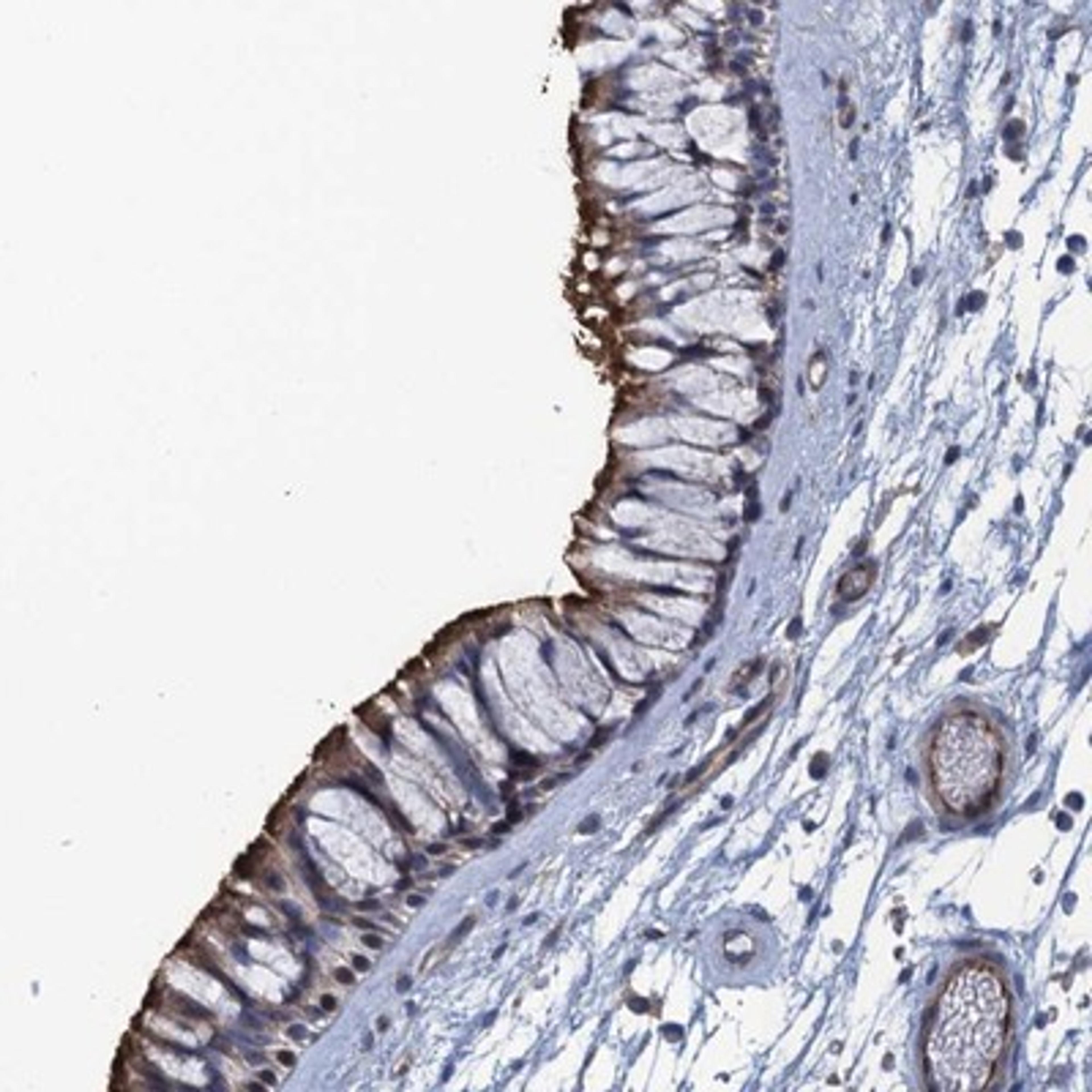 Immunohistochemistry-Paraffin: Munc13-1 Antibody [NBP1-87895] - Staining of human nasopharynx shows distinct membranous positivity in respiratory epithelial cells.