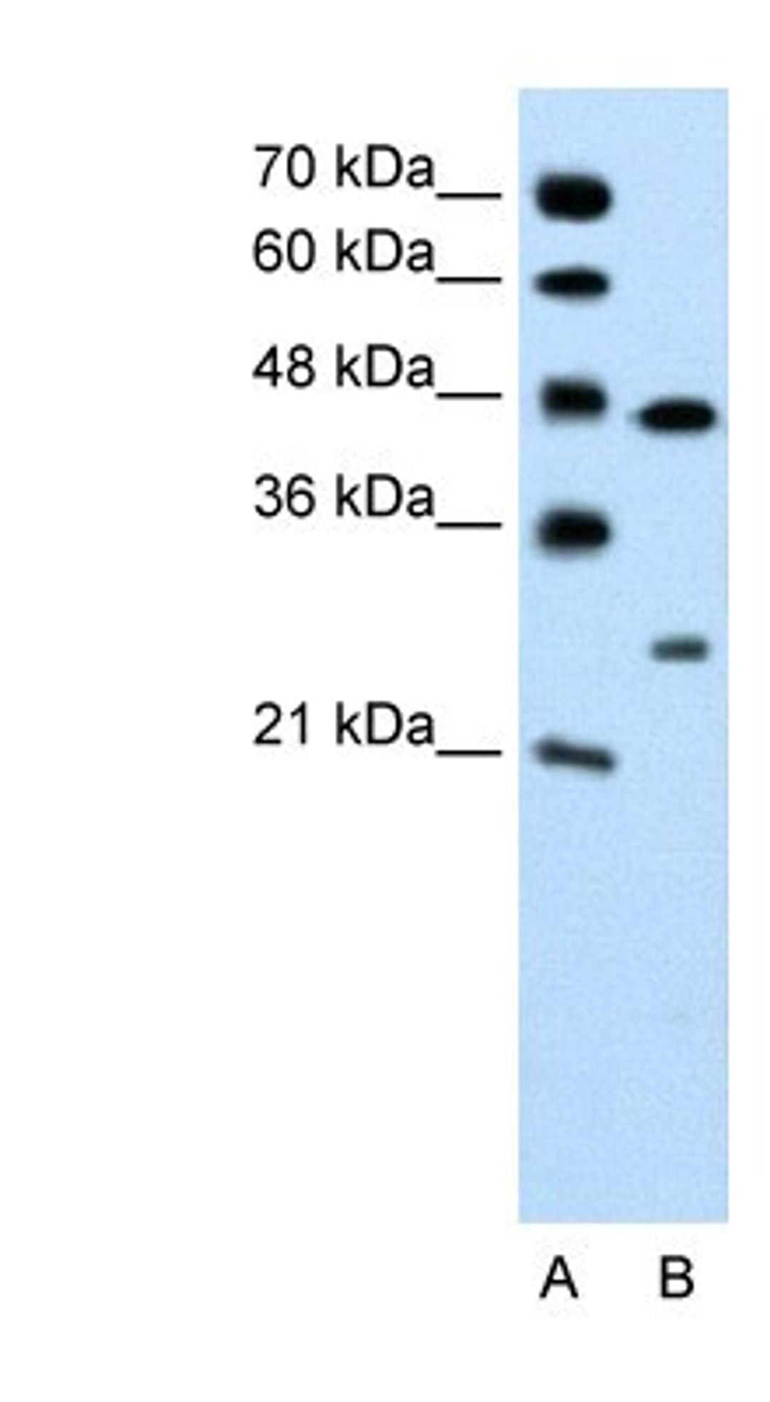 Western Blot: Claudin-18 Antibody [NBP1-60010] - Jurkat cell lysate, concentration 0.2-1 ug/ml.