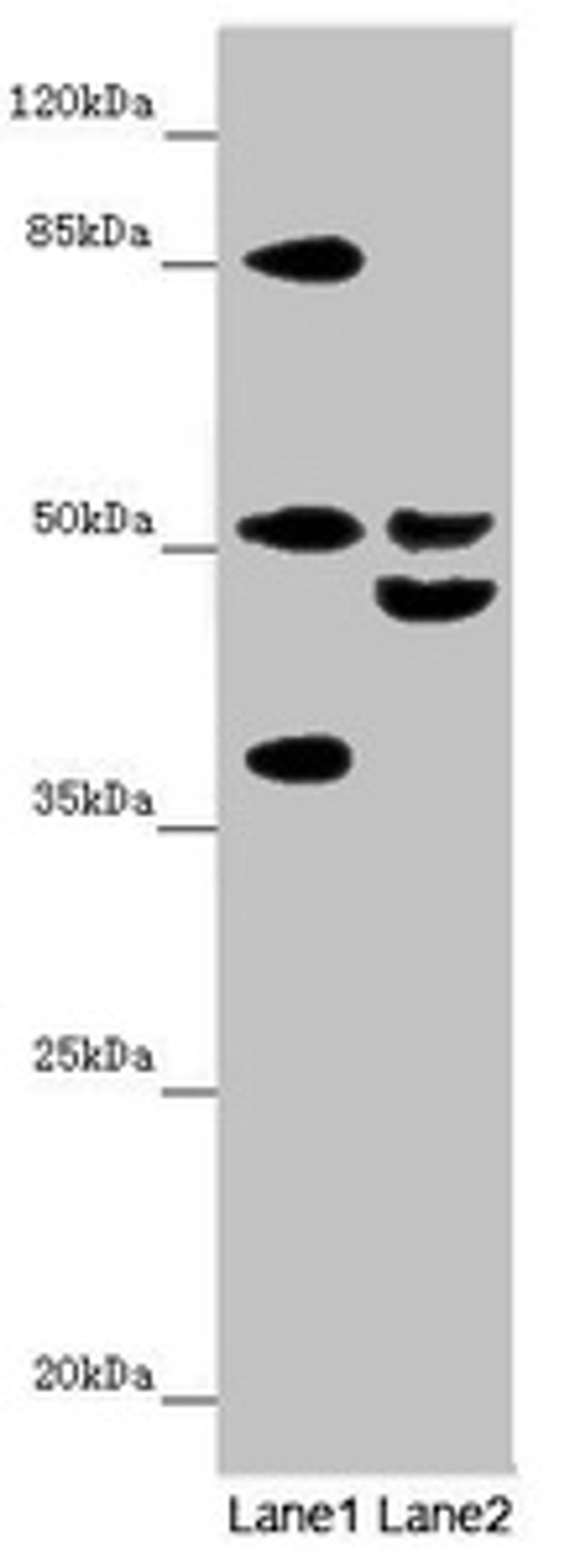 Western blot. All lanes: NYX antibody at 7.23 ug/ml. Lane 1: Mouse gonadal tissue. Lane 2: Mouse liver tissue. Secondary. Goat polyclonal to rabbit IgG at 1/10000 dilution. Predicted band size: 52 kDa. Observed band size: 52, 37, 45, 90 kDa. 