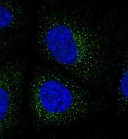 Immunocytochemistry/Immunofluorescence: Collagen VIII alpha 1 Antibody [NBP2-13856] - Staining of human cell line HeLa shows positivity in vesicles. Antibody staining is shown in green.