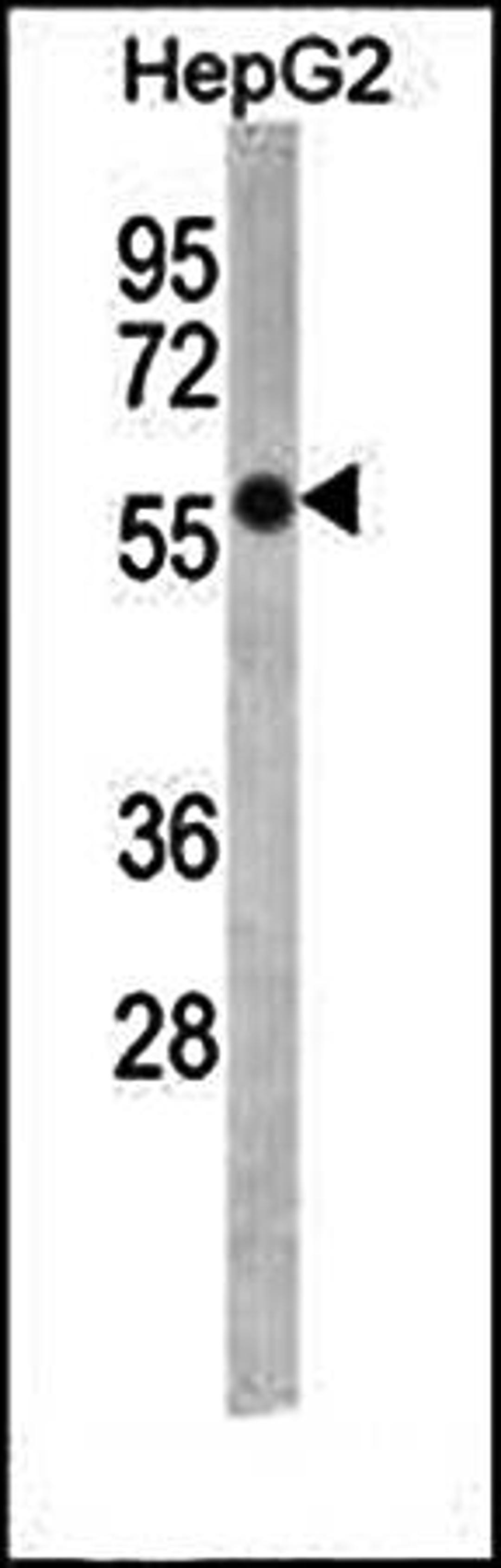 Western blot analysis of FADS2 antibody in HepG2 cell line lysates
