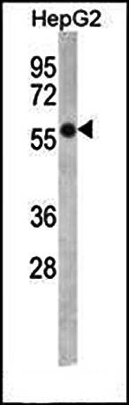 Western blot analysis of FADS2 antibody in HepG2 cell line lysates