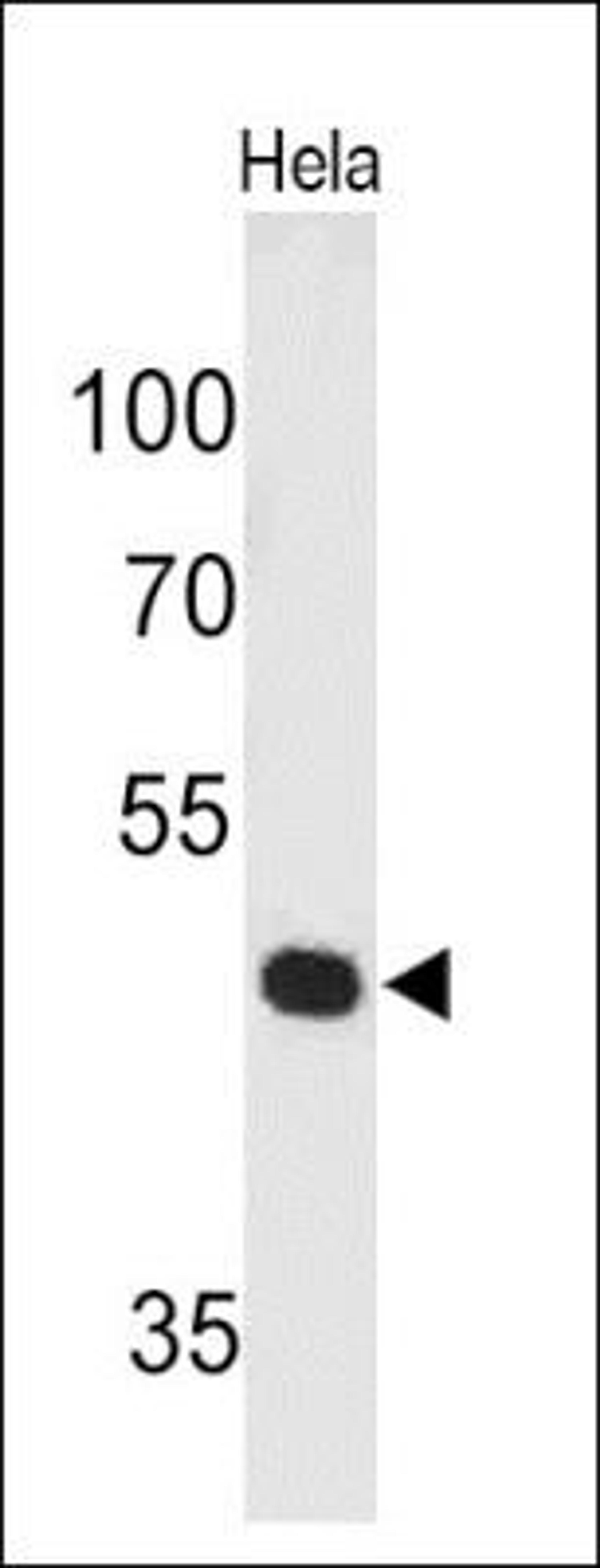 Western Blot: Pax7 Antibody (PAX7/497) [NBP2-32894] - Analysis using the Azide and BSA Free version of NBP2-32894. Detection of PAX7 in human HeLa Cell lysate