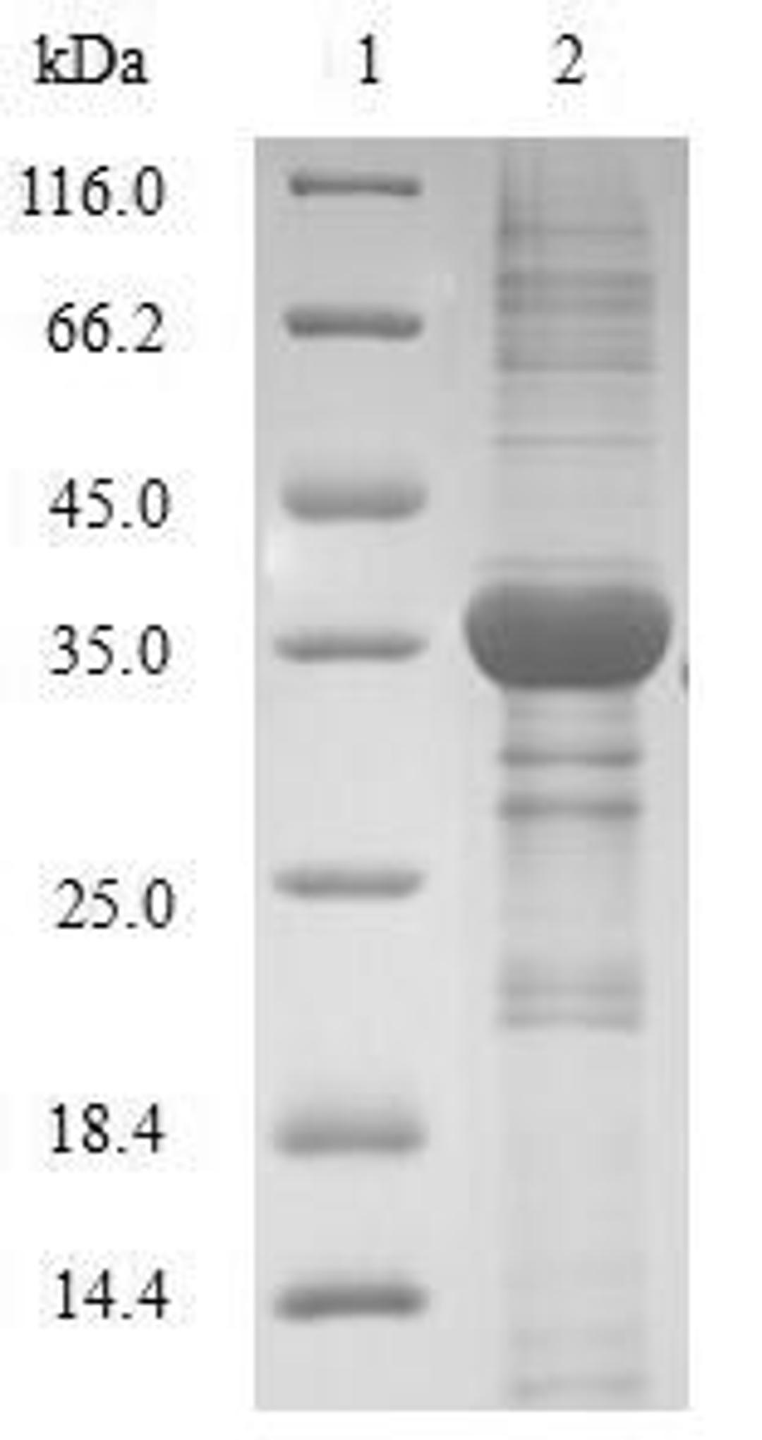 (Tris-Glycine gel) Discontinuous SDS-PAGE (reduced) with 5% enrichment gel and 15% separation gel.