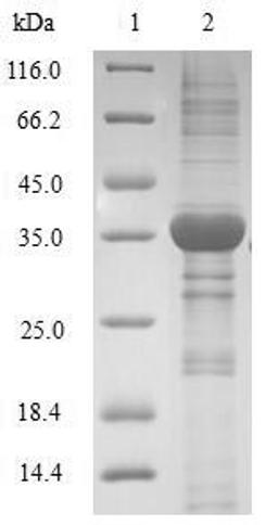(Tris-Glycine gel) Discontinuous SDS-PAGE (reduced) with 5% enrichment gel and 15% separation gel.