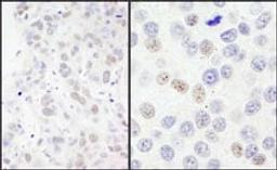 Detection of human NBS1 by immunohistochemistry.