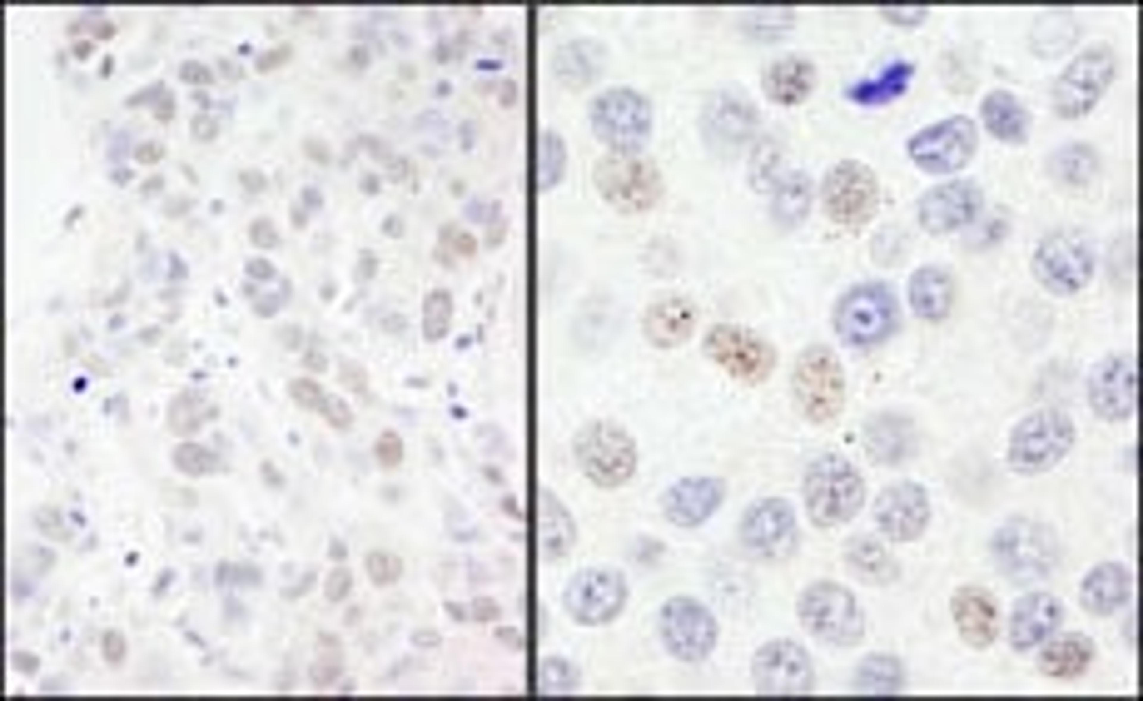 Detection of human NBS1 by immunohistochemistry.