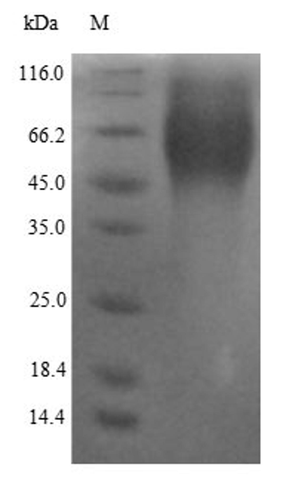 (Tris-Glycine gel) Discontinuous SDS-PAGE (reduced) with 5% enrichment gel and 15% separation gel.