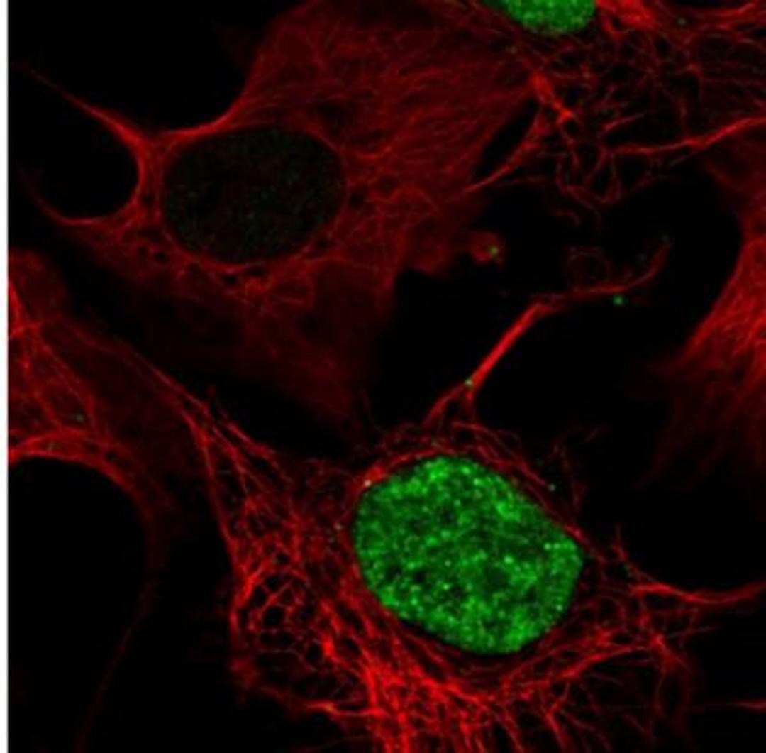 Immunofluorescence: CECR2 Antibody [NBP1-81378] - Staining of human cell line U-2 OS shows positivity in nucleus. Antibody staining is shown in green.