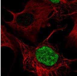 Immunofluorescence: CECR2 Antibody [NBP1-81378] - Staining of human cell line U-2 OS shows positivity in nucleus. Antibody staining is shown in green.