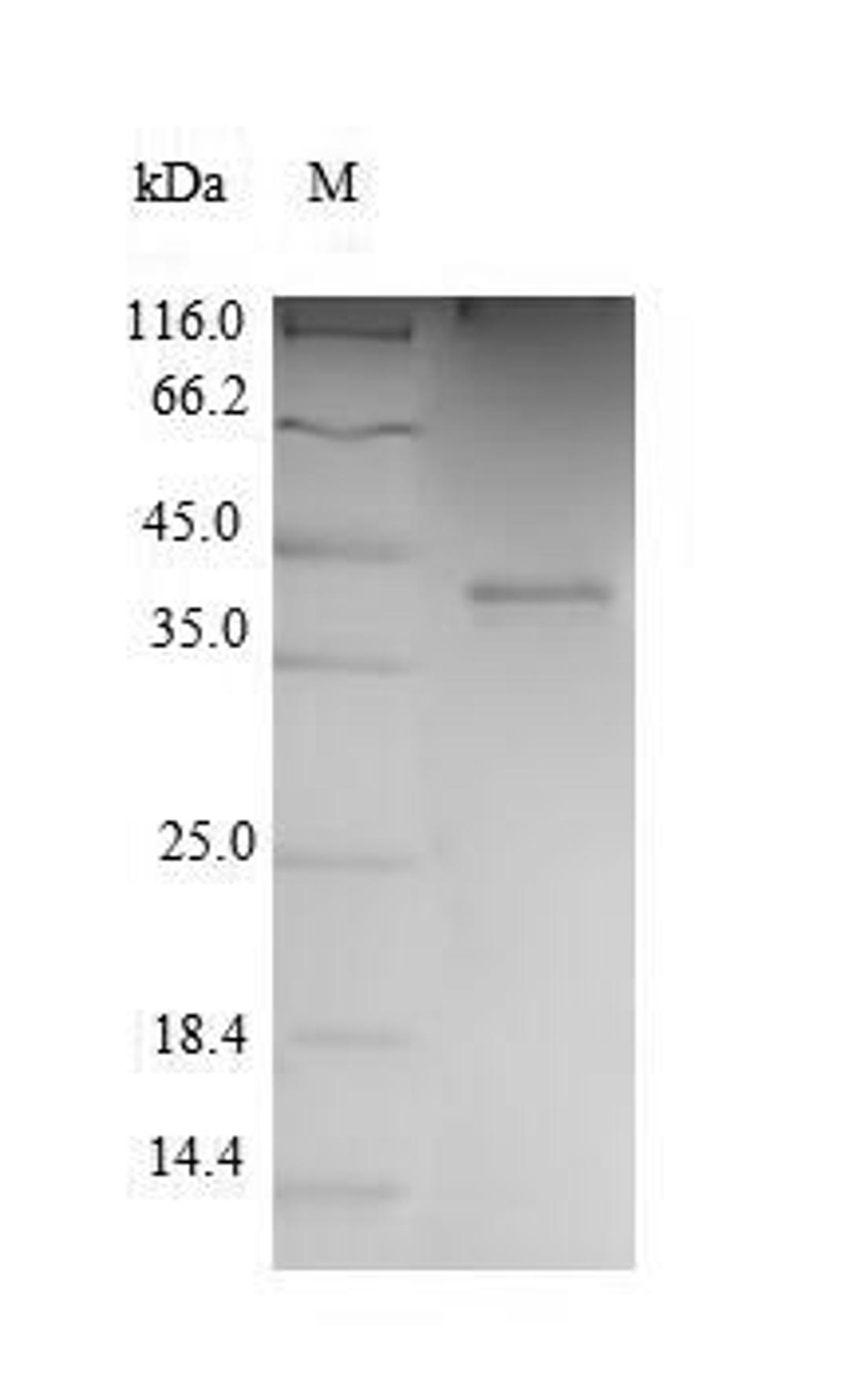 (Tris-Glycine gel) Discontinuous SDS-PAGE (reduced) with 5% enrichment gel and 15% separation gel.