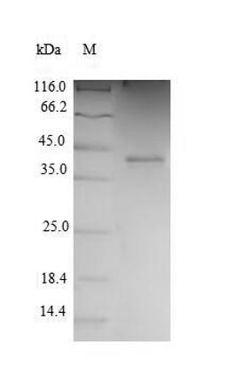 (Tris-Glycine gel) Discontinuous SDS-PAGE (reduced) with 5% enrichment gel and 15% separation gel.