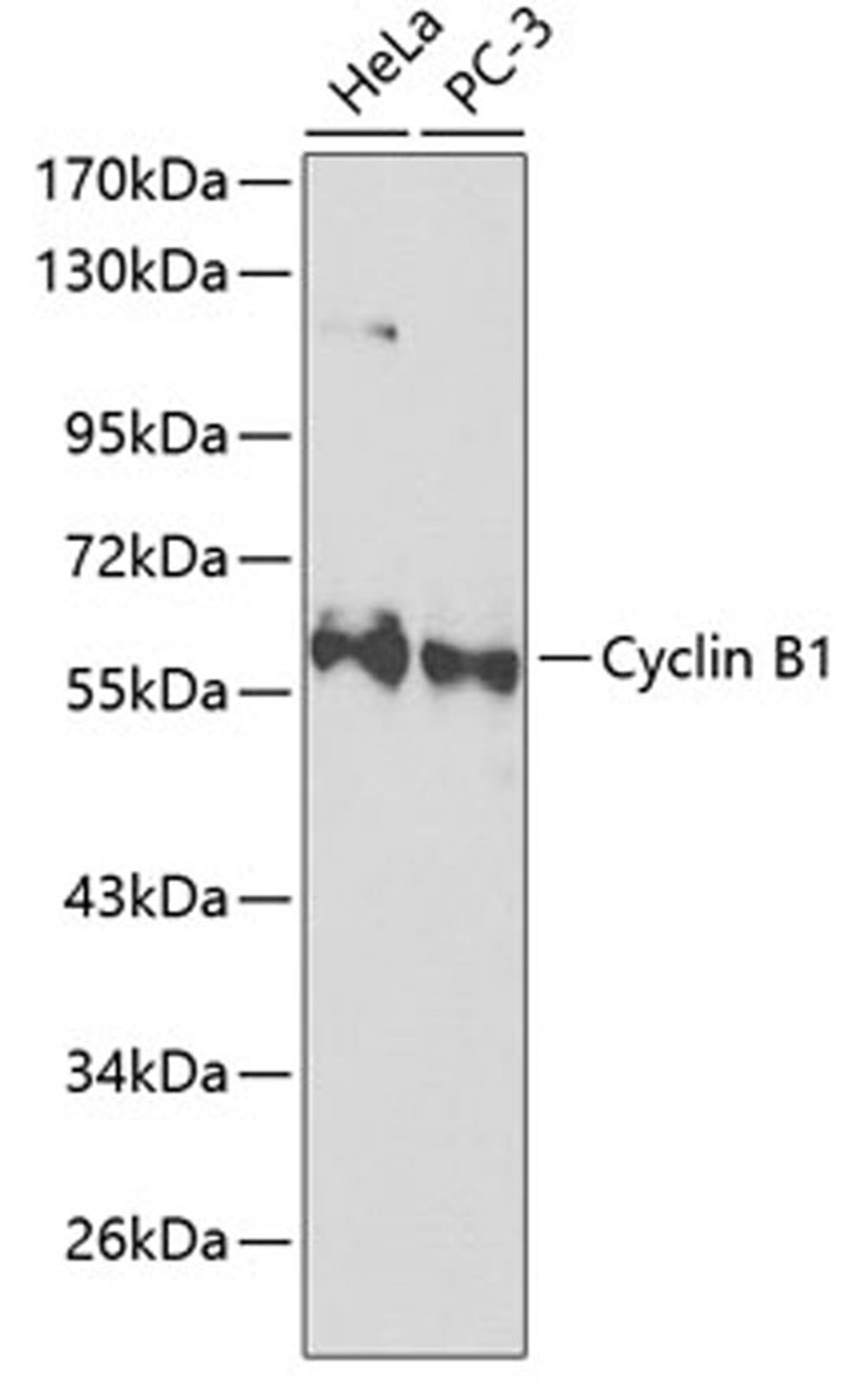 Western blot - Cyclin B1 Antibody (A2056)