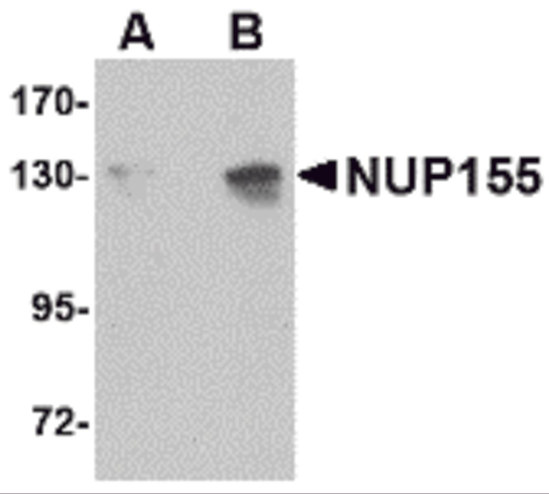 Western blot analysis of NUP155 in P815 cell lysate with NUP155 antibody at (A) 0.5 and (B) 1 μg/mL.