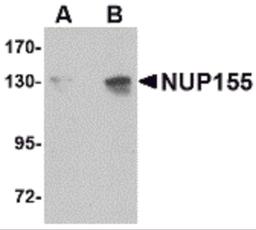Western blot analysis of NUP155 in P815 cell lysate with NUP155 antibody at (A) 0.5 and (B) 1 μg/mL.