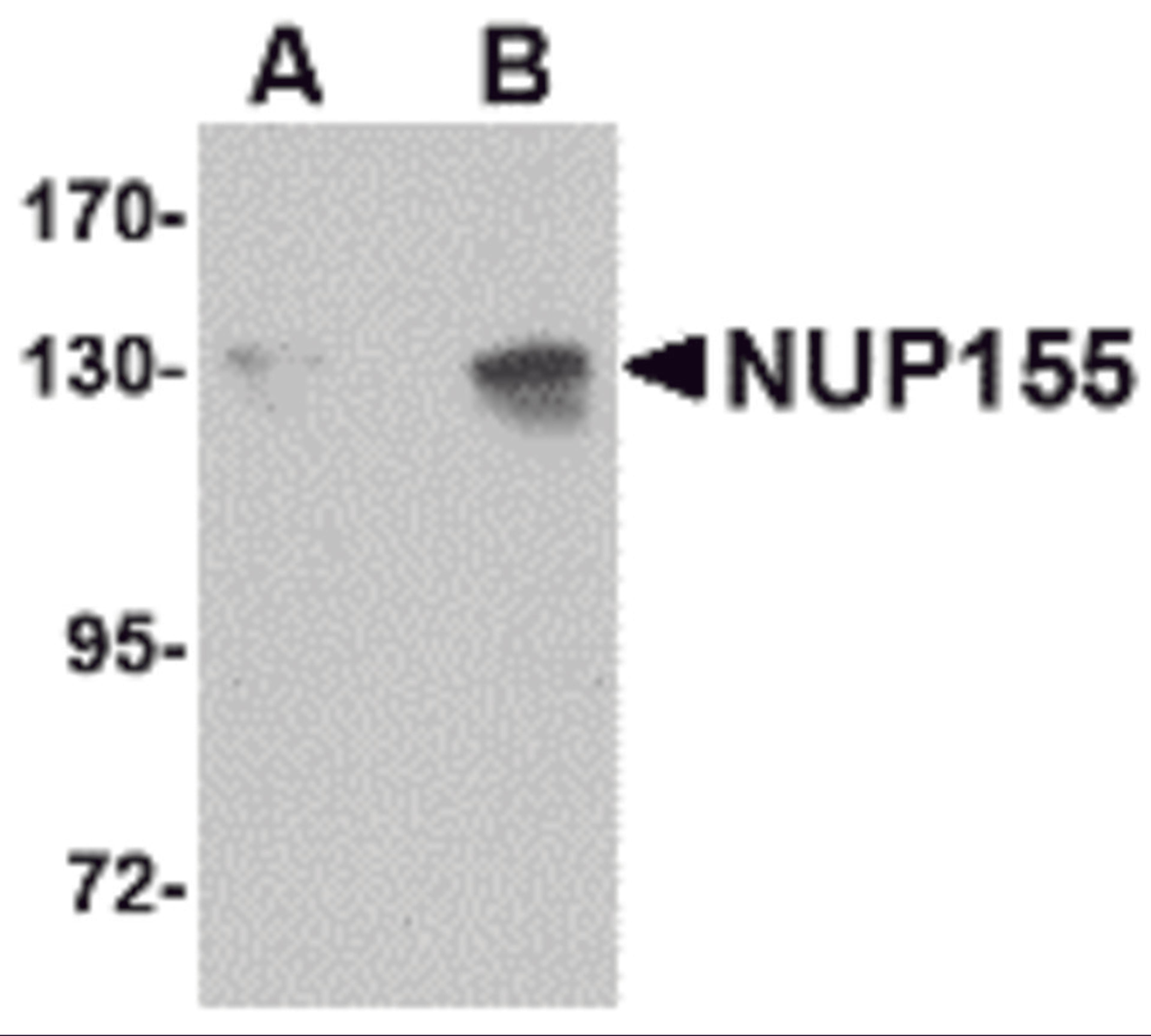 Western blot analysis of NUP155 in P815 cell lysate with NUP155 antibody at (A) 0.5 and (B) 1 μg/mL.