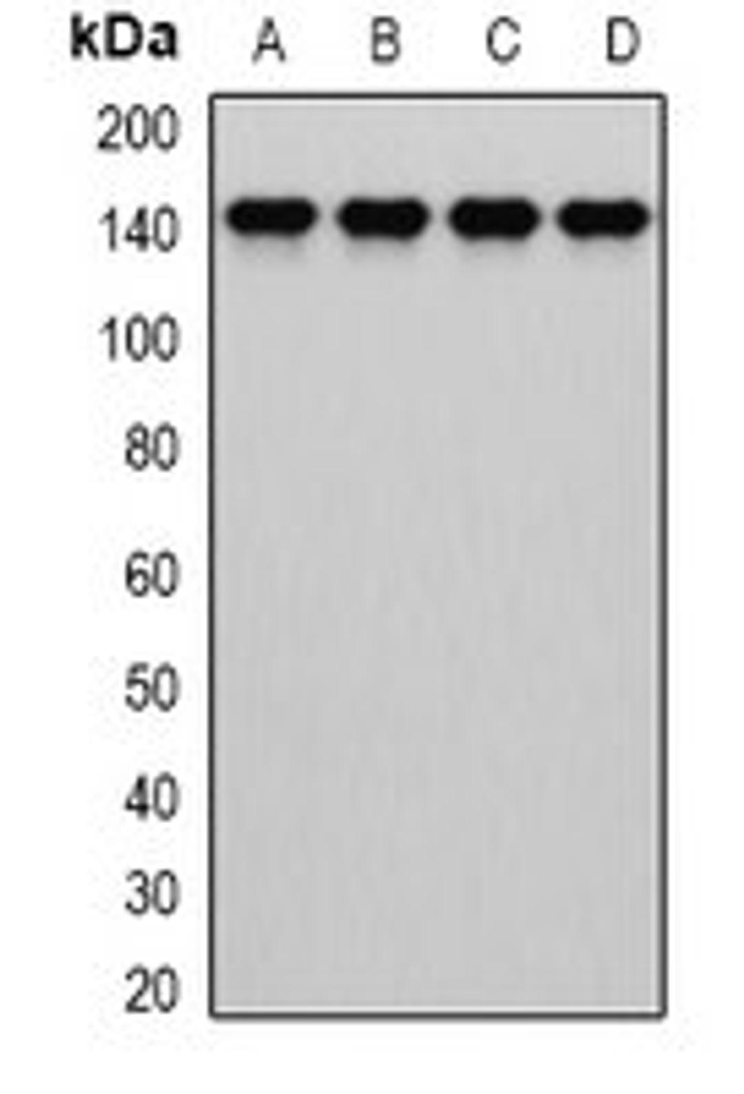 Western blot analysis of MCF7 (Lane1), HepG2 (Lane2), mouse liver (Lane3), mouse lung (Lane4) whole cell lysates using DIAPH1 antibody