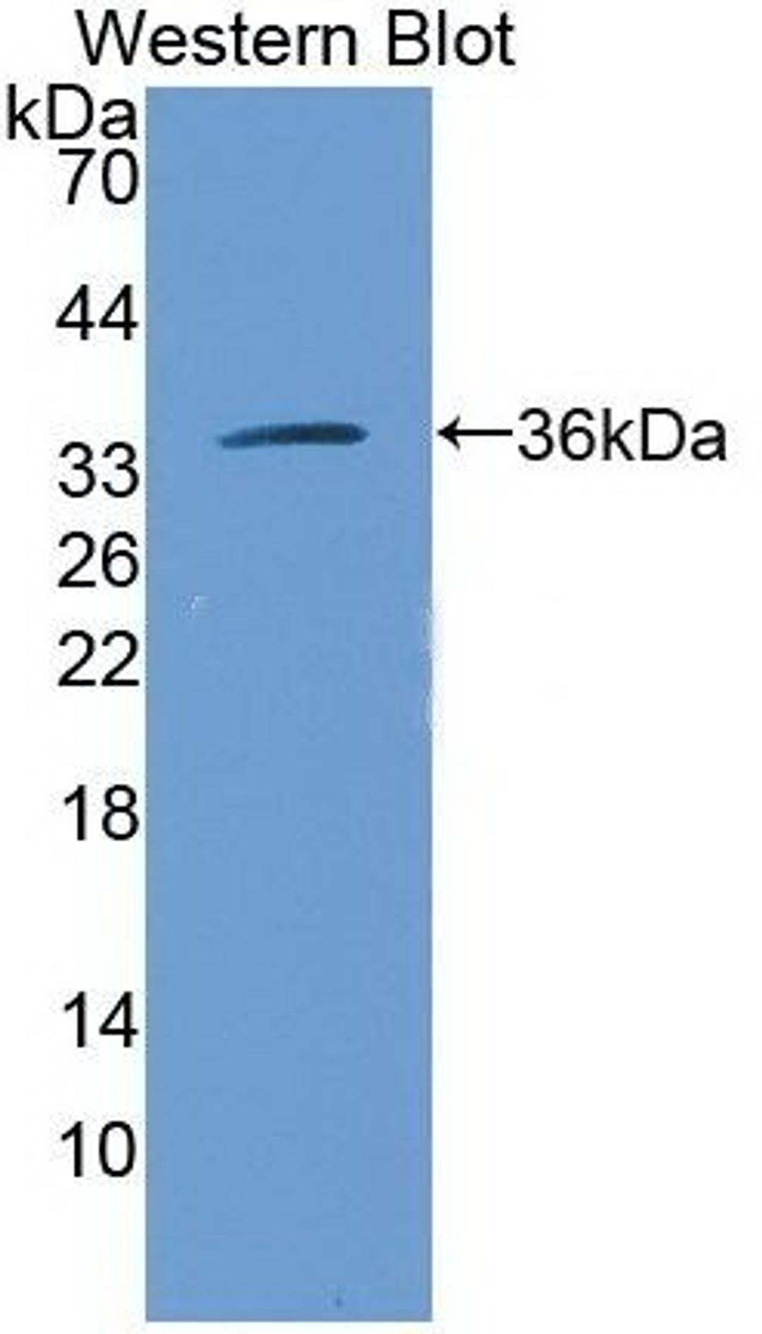 Western blot analysis of recombinant ARG1 antibody