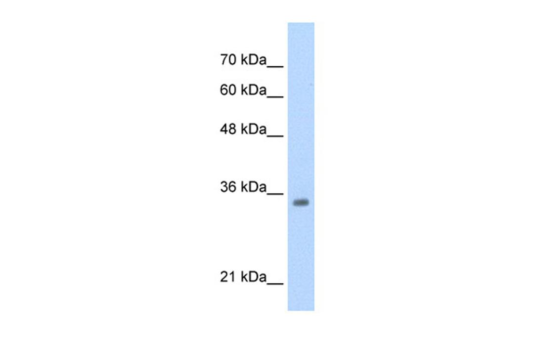 Antibody used in WB on HepG2 at 0.2-1 ug/ml.