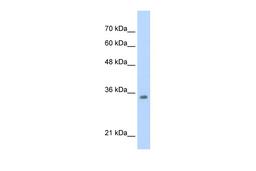 Antibody used in WB on HepG2 at 0.2-1 ug/ml.