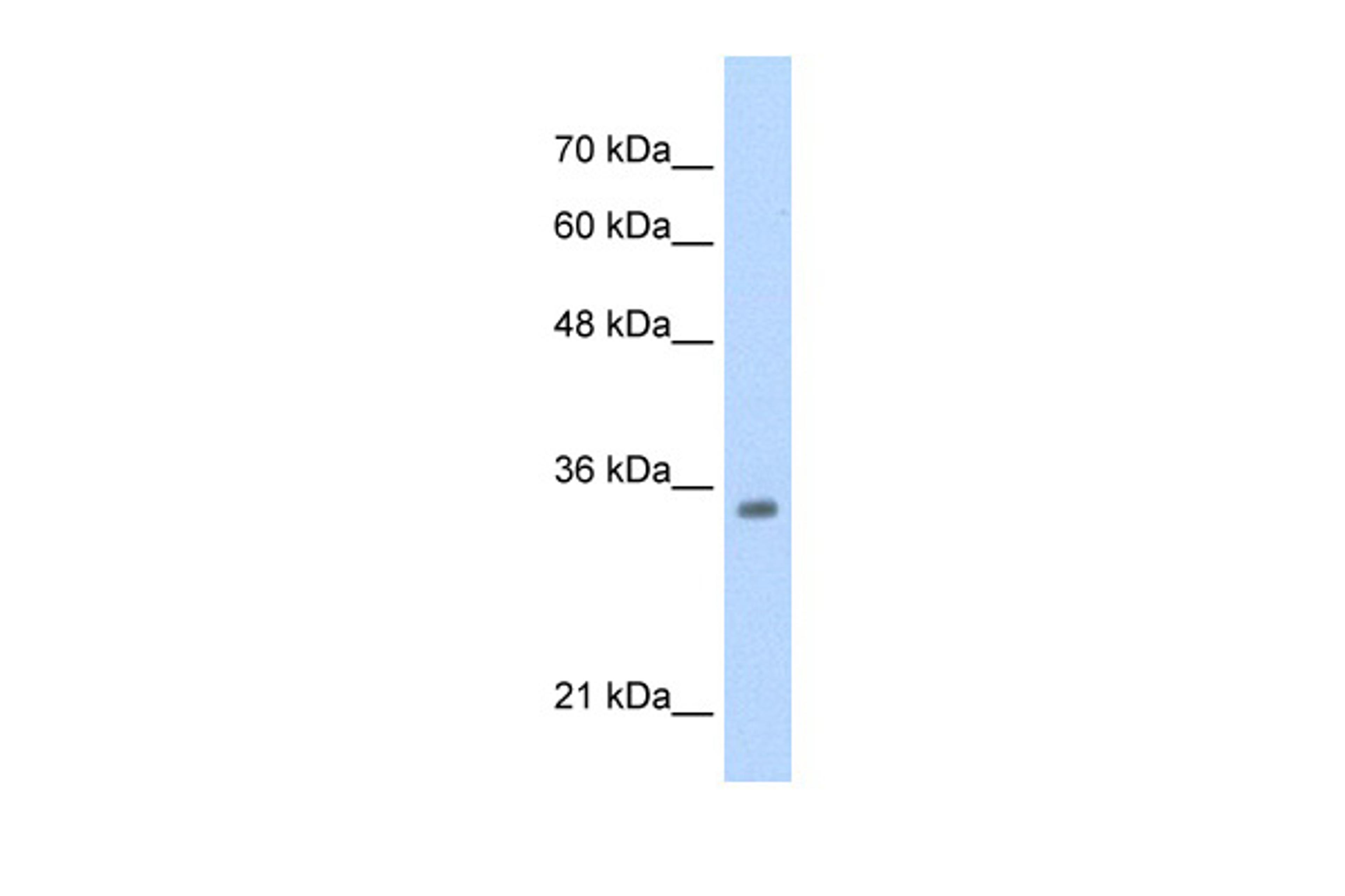 Antibody used in WB on HepG2 at 0.2-1 ug/ml.